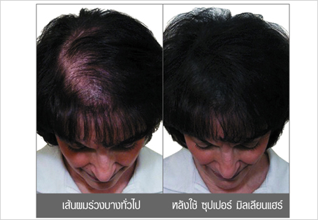 เส้นผมเทียม Supermillion Hair Fiber จากญี่ปุ่น เพิ่มปริมาณเส้นผม รูปที่ 3