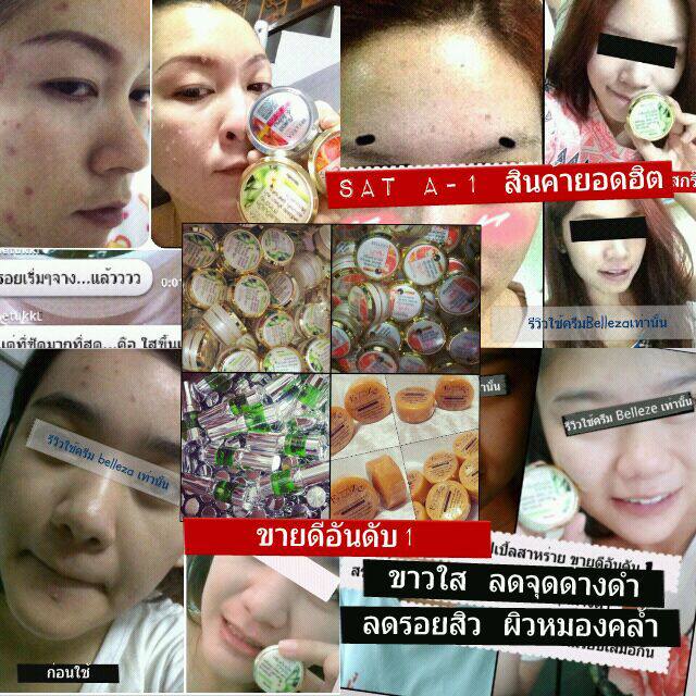 ครีมBelleza ครีม Amy Stemcall ครีมหน้าขาวใส ไร้สิว ฝ้า กระ จุดด่างดำ ปลอดภัย  มีอย. เห็นผล ใน 7-14วัน !!(รับสมัครตัวแทนจ รูปที่ 1