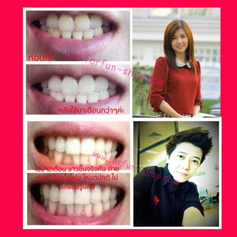 จำหน่ายผงขัดฟันขาว ช่วยขจัดคราบฟันเหลืองจาก ชา กาแฟ บุหรี่  รูปที่ 4