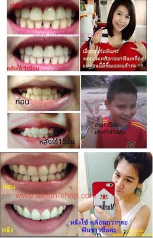 จำหน่ายผงขัดฟันขาว ช่วยขจัดคราบฟันเหลืองจาก ชา กาแฟ บุหรี่  รูปที่ 3