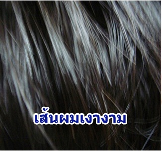 รังแค ทำให้คุณขาดความมั่นใจ รูปที่ 3
