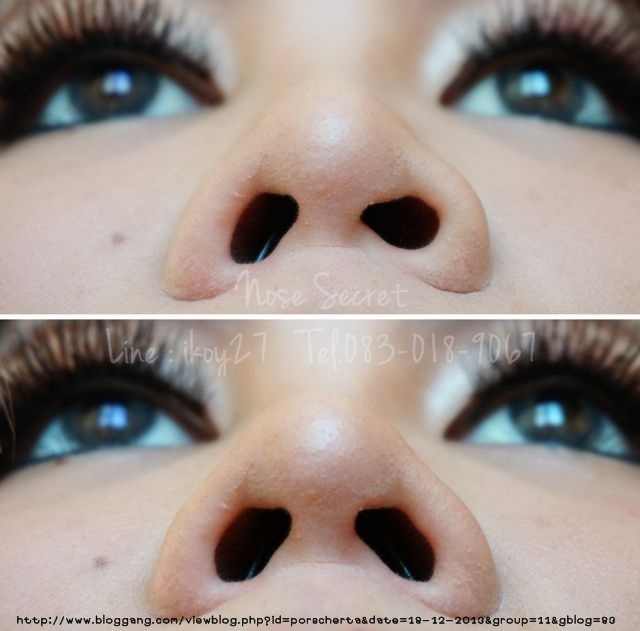 ● Nose Secret อุปกรณ์เสริมดั้งโด่ง โดยไม่ต้องศัลยกรรม ● รูปที่ 4