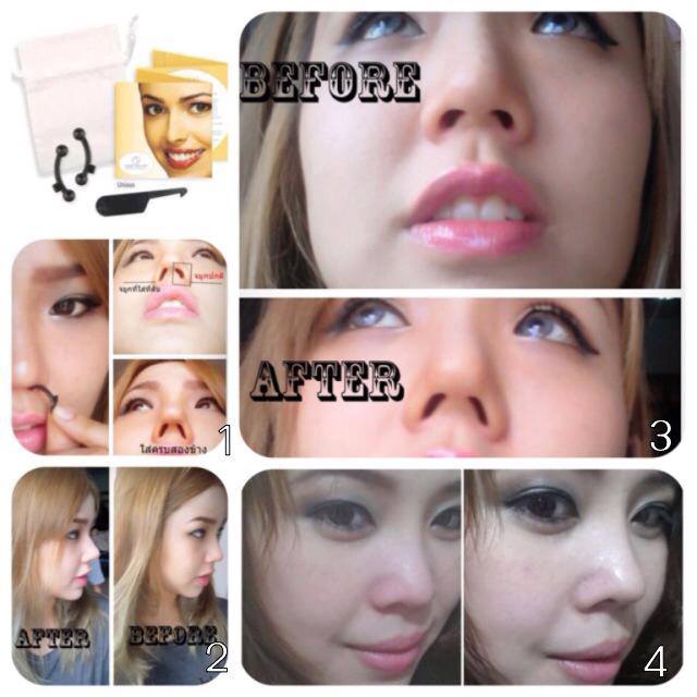 ● Nose Secret อุปกรณ์เสริมดั้งโด่ง โดยไม่ต้องศัลยกรรม ● รูปที่ 1