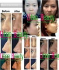 www.urbanbeautythailand.com - Nose Reshaping Surgery Thailand Is Not Just Cosmetic with Expert Plastic Surgery Thailand 