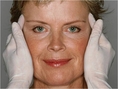 www.urbanbeautythailand.com - Botox/Filler/Meso Thailand, Save up to 70% on Treatment in Thailand! Free Consultation