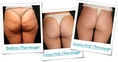  www.urbanbeautythailand.com - Thermage Thailand: Non-surgical Facelift & Skin Tightening Bangkok Phuket, Thailand