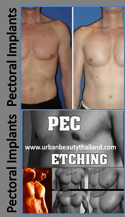www.urbanbeautythailand.com - Pectoral Implants Thailand; Thai's Most Experienced & Trusted Surgeons รูปที่ 1