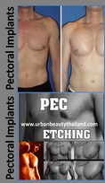 www.urbanbeautythailand.com - Pectoral Implants Thailand; Thai's Most Experienced & Trusted Surgeons