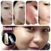 รูปย่อ Snail Cream - ครีมหอยทาก สิวหาย สิวยุบใน 1 คืน รูปที่3