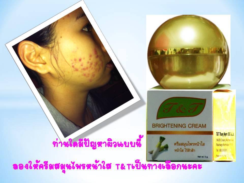 อยากหน้าใส ใช้ครีมหน้าใสที่ใช้ดีและปลอดภัย ครีมลดสิว ฝ้า กระ จุดด่างดำ รูปที่ 6