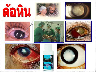 อายแคร์ซอฟเจล Eyecare Softgel รูปที่ 5