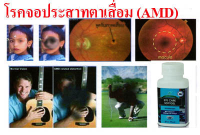 อายแคร์ซอฟเจล Eyecare Softgel รูปที่ 6