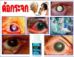 อายแคร์ซอฟเจล Eyecare Softgel รูปที่ 4