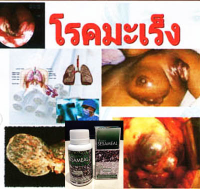 สารสกัดจากงาดำ Sesaminในเอมมูร่า AIMMURA รูปที่ 7