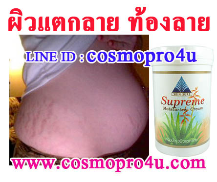 ครีมทาผิวลดรอยแตกลาย ท้องลาย สกินชัวร์ โทร 081-6174247 ได้ผลจริง มี อย รูปที่ 2