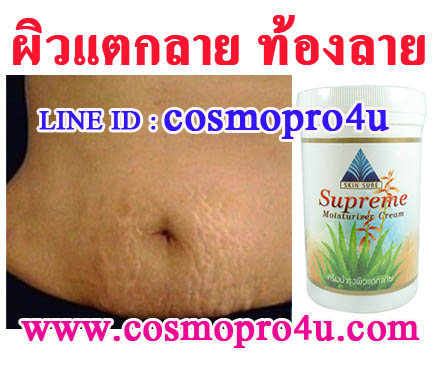 ครีมทาผิวลดรอยแตกลาย ท้องลาย สกินชัวร์ โทร 081-6174247 ได้ผลจริง มี อย รูปที่ 3