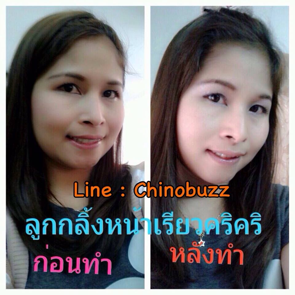 ลูกกลิ้งหน้าเรียว รูปที่ 2