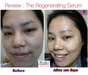 รูปย่อ Botox Serum,The Regenerating Serum รูปที่6