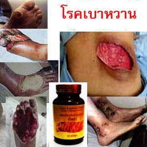 ถั่งเช่า คิวไลฟ์ ราคาถูกกว่า สรรพคุณสูงกว่า รูปที่ 7
