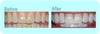 รูปย่อ ฟันขาวออร่า ด้วยยาสีฟันไวท์เทนนิ่ง(ชนิดผง) ฟันขาวยาวนานยิ่งขึ้น ไม่ทำลายสารเคลือบฟัน ลดการเกิดคราบหินปูน  รูปที่3