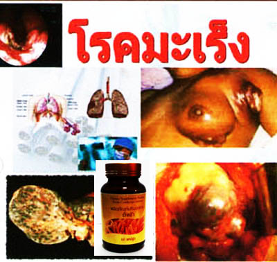 ถั่งเช่า คิวไลฟ์ ราคาถูกกว่า สรรพคุณสูงกว่า รูปที่ 6