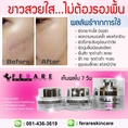 ferare skincare : ที่สุดของครีมบำรุงผิวที่ใช้แล้วเห็นผลจริง แบบสวย-ใส ไม่ต้องรองพื้น