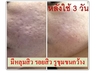 รูปย่อ รูขุมขนกว้าง หน้ามัน กระชับรูขุมขน ลดความมัน ด้วย Miracle Drop เห็นผลใน 7 วัน มีอย รูปที่1