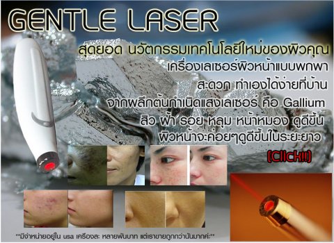 ขายเครื่องรักษาผิวหน้าด้วยLaser รูปที่ 1