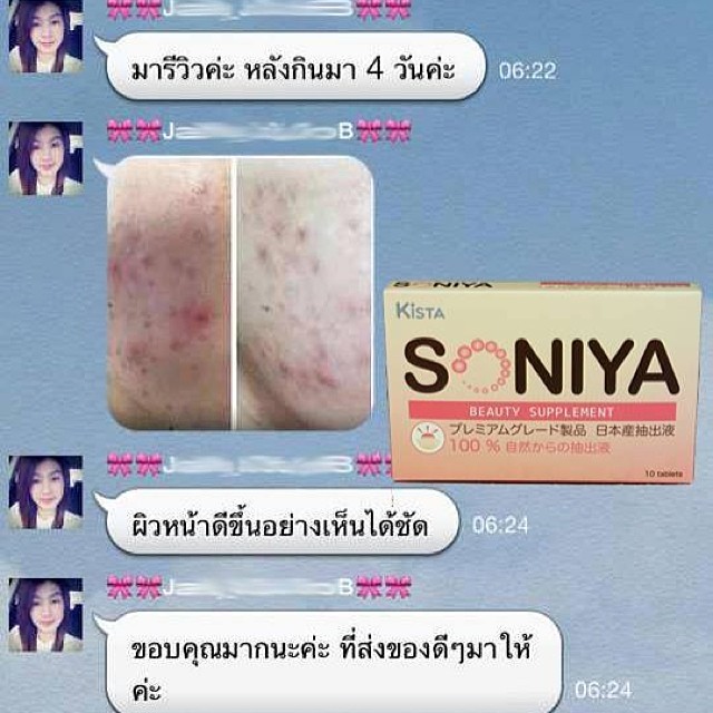 Soniya เกิดมาเพื่อฆ่าสิว รูปที่ 6