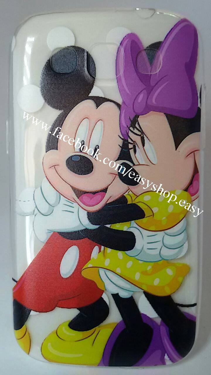 เคสซัมซุงกาแล็คซี่วิน เคสซิลิโคลนใสลายการ์ตูน รูปที่ 2