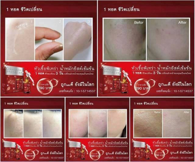 Pitera Galactomyces หัวเชื้อพิเทร่า รูปที่ 4