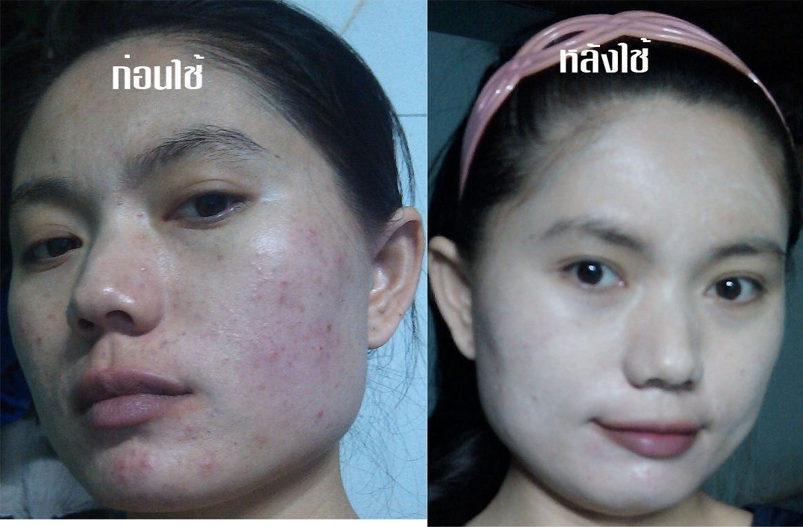 ครีมโสม บัวหิมะ รูปที่ 3