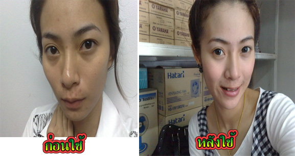 ครีมโสม บัวหิมะ รูปที่ 4