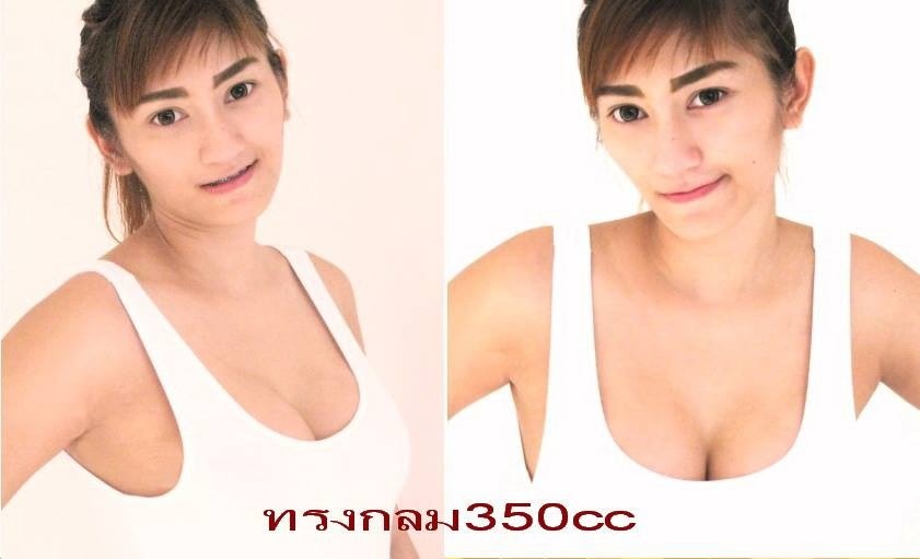 เสริมอึ๋ม อัพไซร์ รูปที่ 1