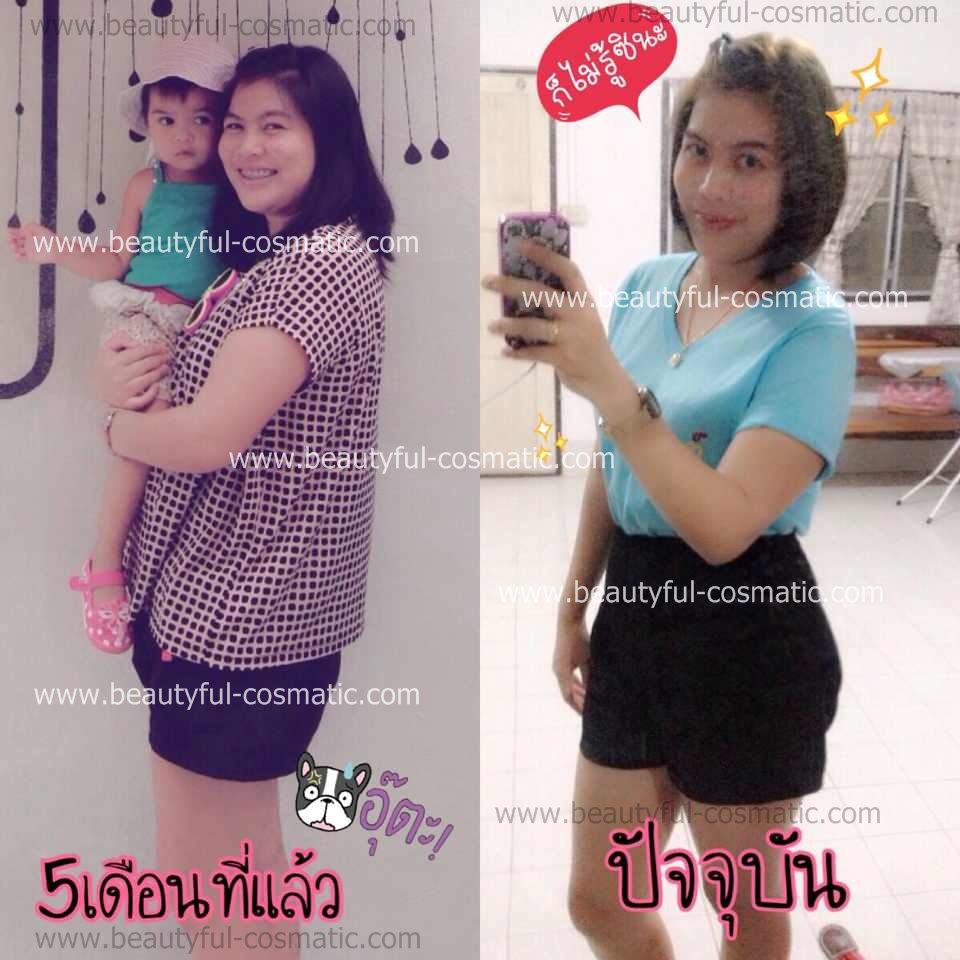 ลดน้ำหนัก ปรับผิวชาว ฟิตกระชับคืนความสาว รีวิวเกิน100 รูปที่ 1