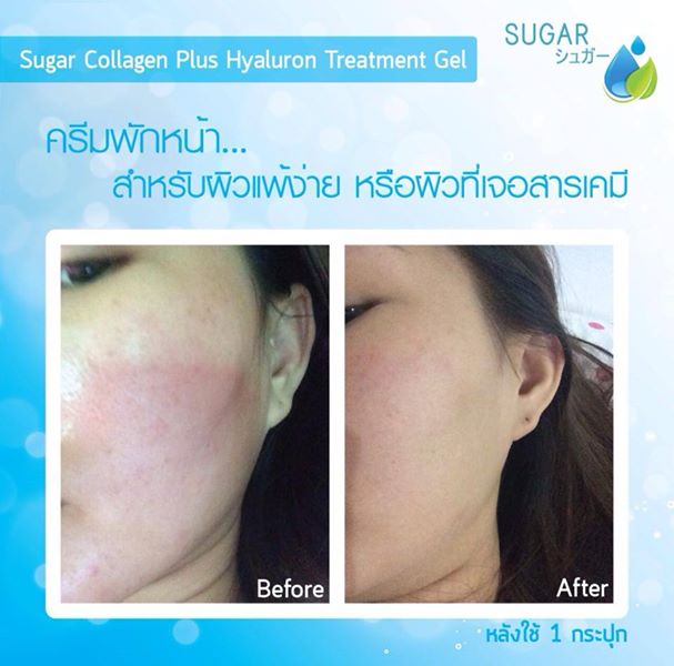 ครีมพักหน้า Sugar collagen gel รูปที่ 7