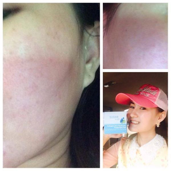 ครีมพักหน้า Sugar collagen gel รูปที่ 3