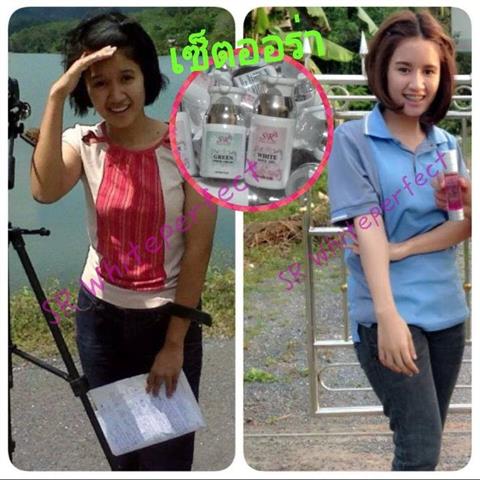 จำหน่ายแชมพูยาจีนเร่งผมยาวและมาร์คเพอซี่หน้าใสในหนึ่งคืน,เซตขาวออร่าคู่หูขาวชัวร์ รูปที่ 4