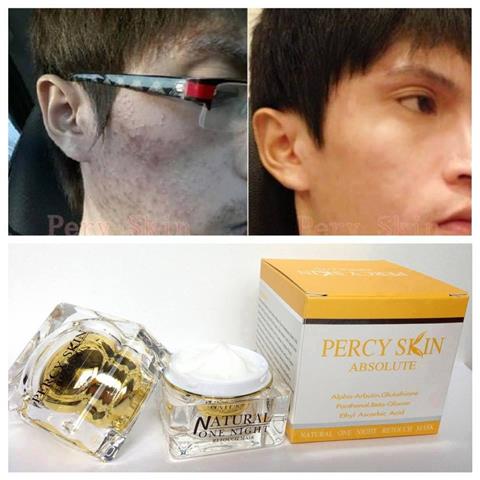 จำหน่ายแชมพูยาจีนเร่งผมยาวและมาร์คเพอซี่หน้าใสในหนึ่งคืน,เซตขาวออร่าคู่หูขาวชัวร์ รูปที่ 6