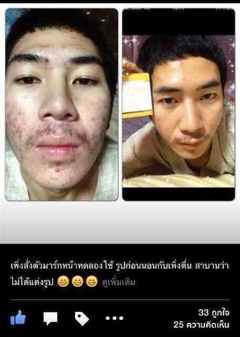 จำหน่ายแชมพูยาจีนเร่งผมยาวและมาร์คเพอซี่หน้าใสในหนึ่งคืน,เซตขาวออร่าคู่หูขาวชัวร์ รูปที่ 7