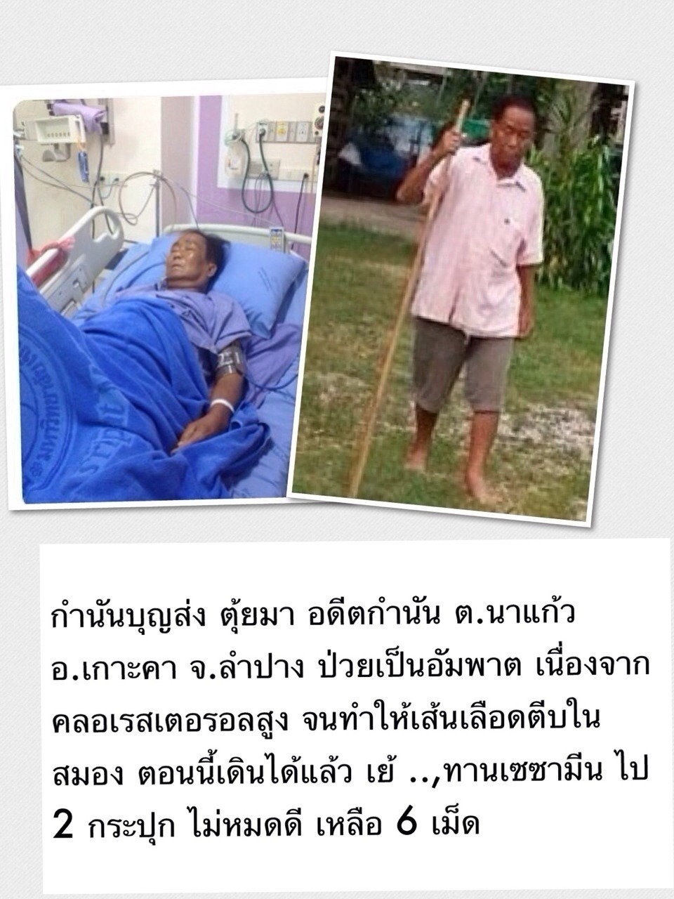 ขายอาหารเสริมงาดำ เอมมูร่าเซซามิน บำบัดดูแลรักษาอาการข้อเสื่อม ข้ออักเสบ เก๊า กระดูกพรุน รูปที่ 5