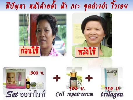 หน้าขาวใสออร่า ด้วยออร่าไวท์ชุดใหญ่ ลด ฝ้า กระ หน้าหมองคล้ำ ลดรอยแดงรอยดำจากสิว เหมาะสำหรับผู้ที่อายุ 30+ รูปที่ 2