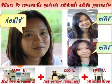ชุดออร่าไวท์ (Mini set) สำหรับท่านที่มีปัญหาฝ้า กระ จุดด่างดำ หน้าหมองคล้ำ หลังใช้ 1-2 สัปดาห์หน้าจะขาวใสออร่ามากเลยค่ะ รูปที่ 3