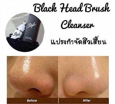 แปรงกำจัดสิวเสี้ยน รูปที่ 3