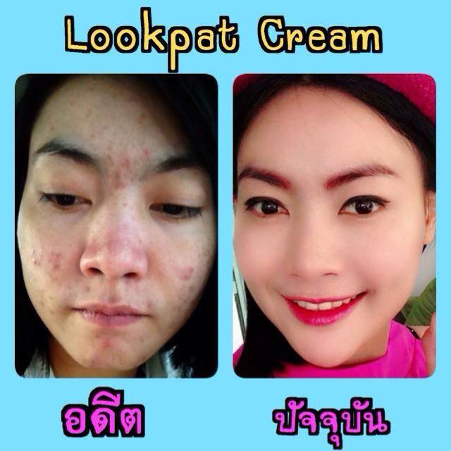 Lookpat Cream รูปที่ 1