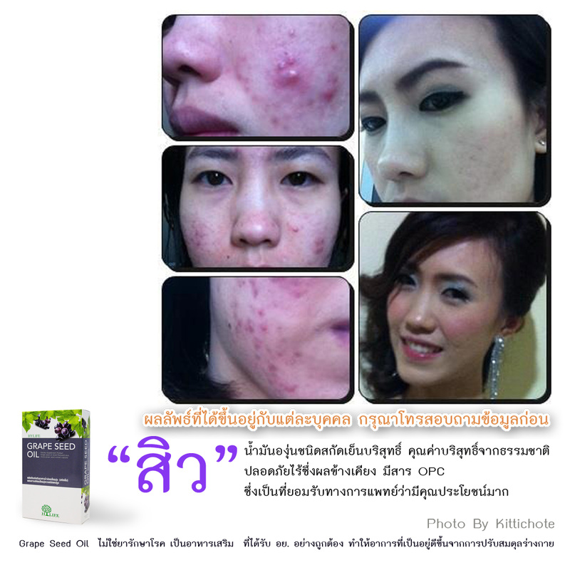 Grape Seed Oil.(น้ำมันสกัดจากเมล็ดองุ่นชนิดสกัดเย็น) รูปที่ 6