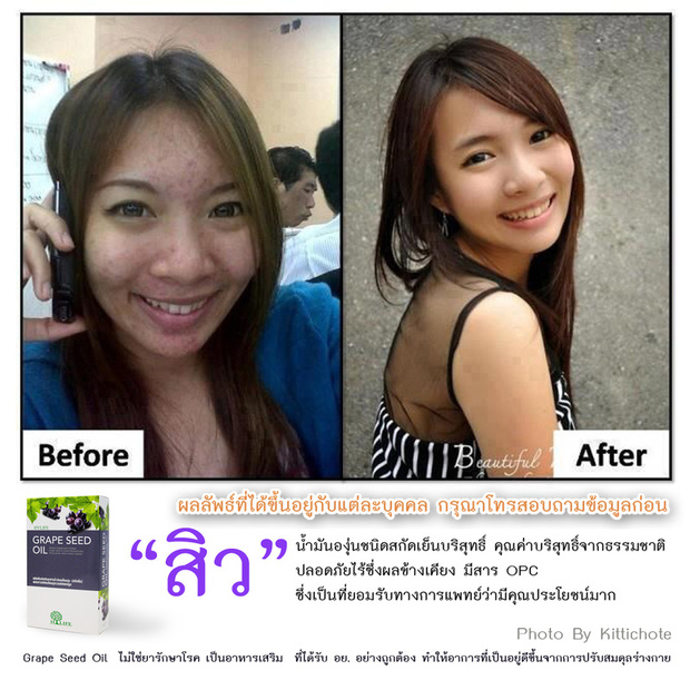 Grape Seed Oil.(น้ำมันสกัดจากเมล็ดองุ่นชนิดสกัดเย็น) รูปที่ 2