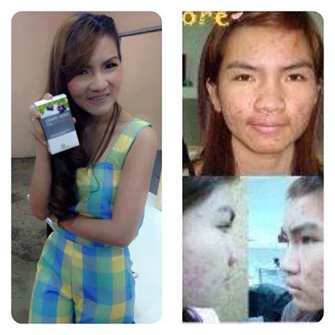 Grape Seed Oil.(น้ำมันสกัดจากเมล็ดองุ่นชนิดสกัดเย็น) รูปที่ 4