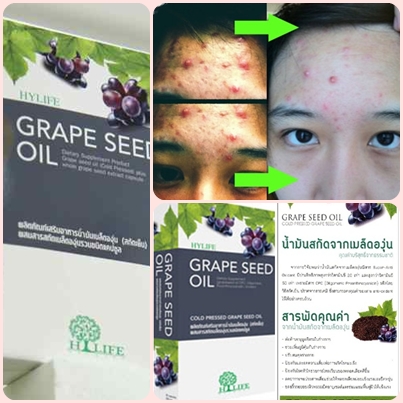 Grape Seed Oil.(น้ำมันสกัดจากเมล็ดองุ่นชนิดสกัดเย็น) รูปที่ 5