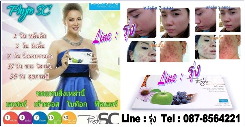 Phyto SC Stem Cell สุดยอดสเต็มเซลล์ รูปที่ 1